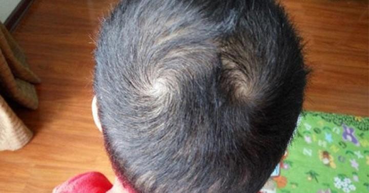 Người có 2 xoáy tóc: Cực kì thông minh, làm nên chuyện lớn, mang số giàu có, đào hoa | Tử Vi Cổ Học