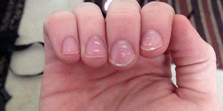 Hạt gạo trên móng tay có ý nghĩa gì? | Tử Vi Cổ Học