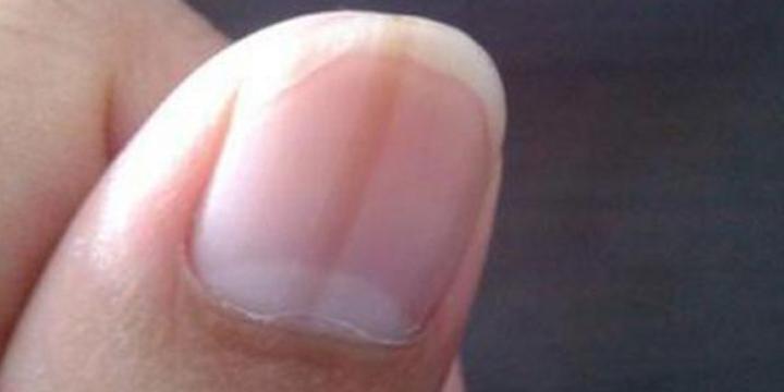 Ý nghĩa của móng tay hình bán nguyệt | Tử Vi Cổ Học